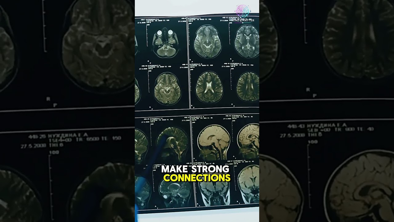 Why Do We Forget Things? Here’s the Science! 