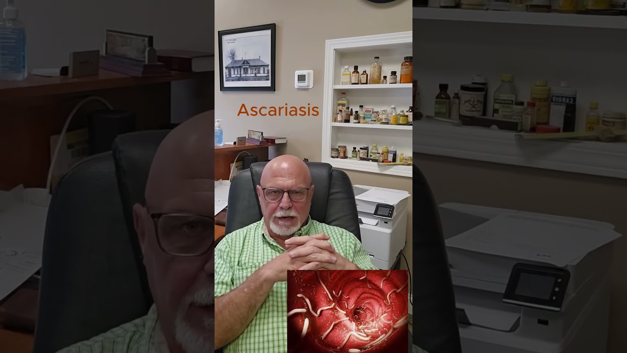 Ascariasis - parasitic roundworm #MedicalTikTok #DoctorTikTok #TikTokDoctor #LearnOnTikTok