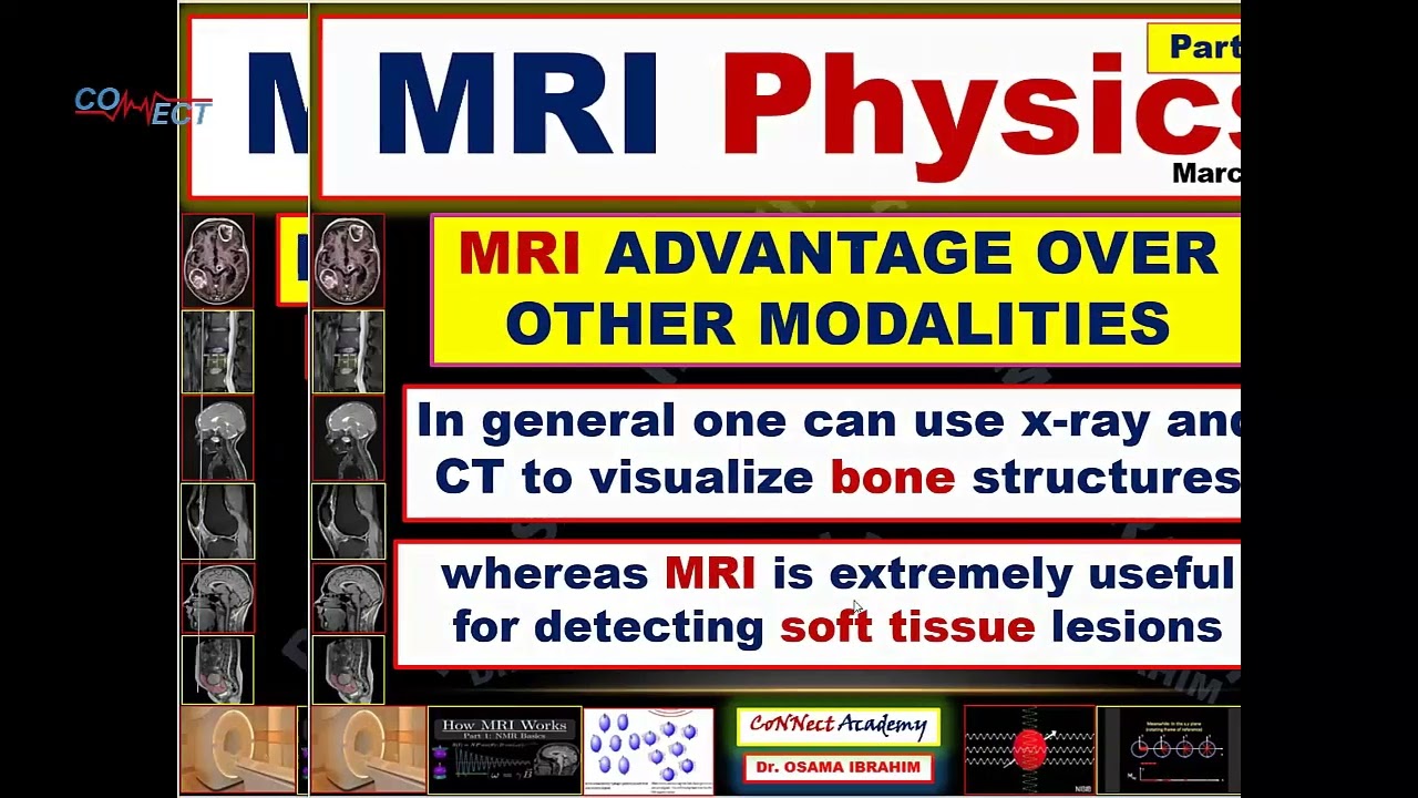 MRI من أول نظرة: المحاضرة اللي بتفهمك الفيزياء بدل ما تحفظها.