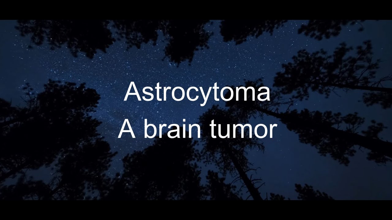 How AI is changing Astrocytoma treatment. Learn with AstroCare Companion AI