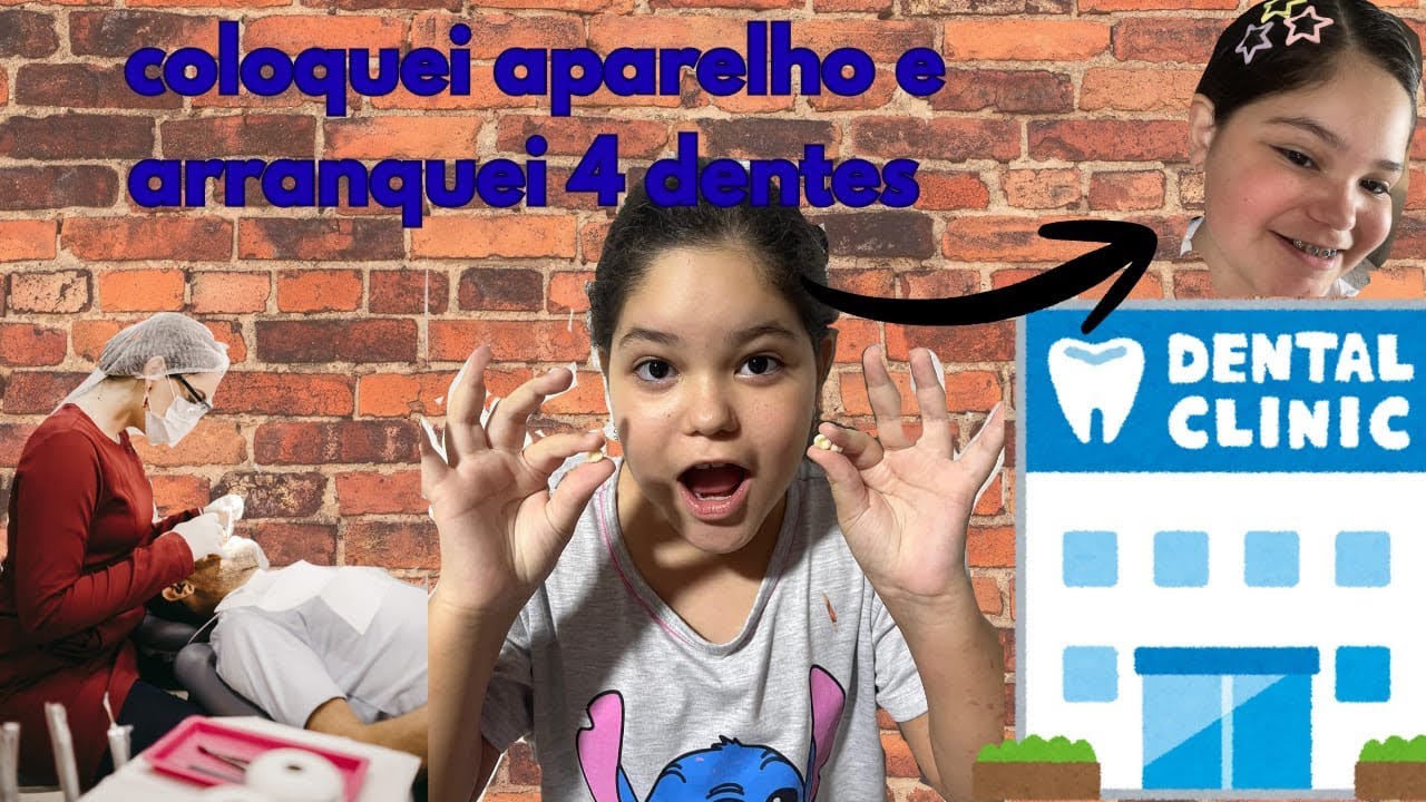 Coloquei aparelho e tirei 4 🦷 😱( Valentina)