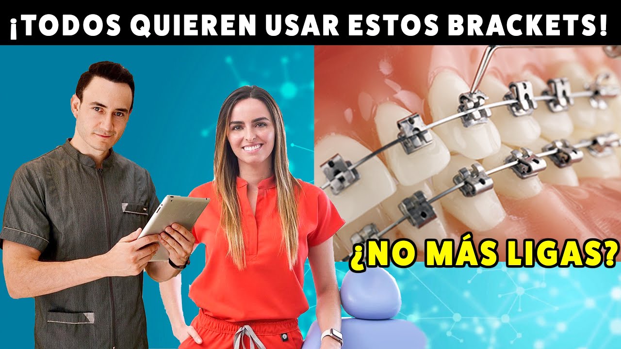 ¿Por qué ahora todos quieren brackets de autoligado? Las ventajas de NO tener ligas.