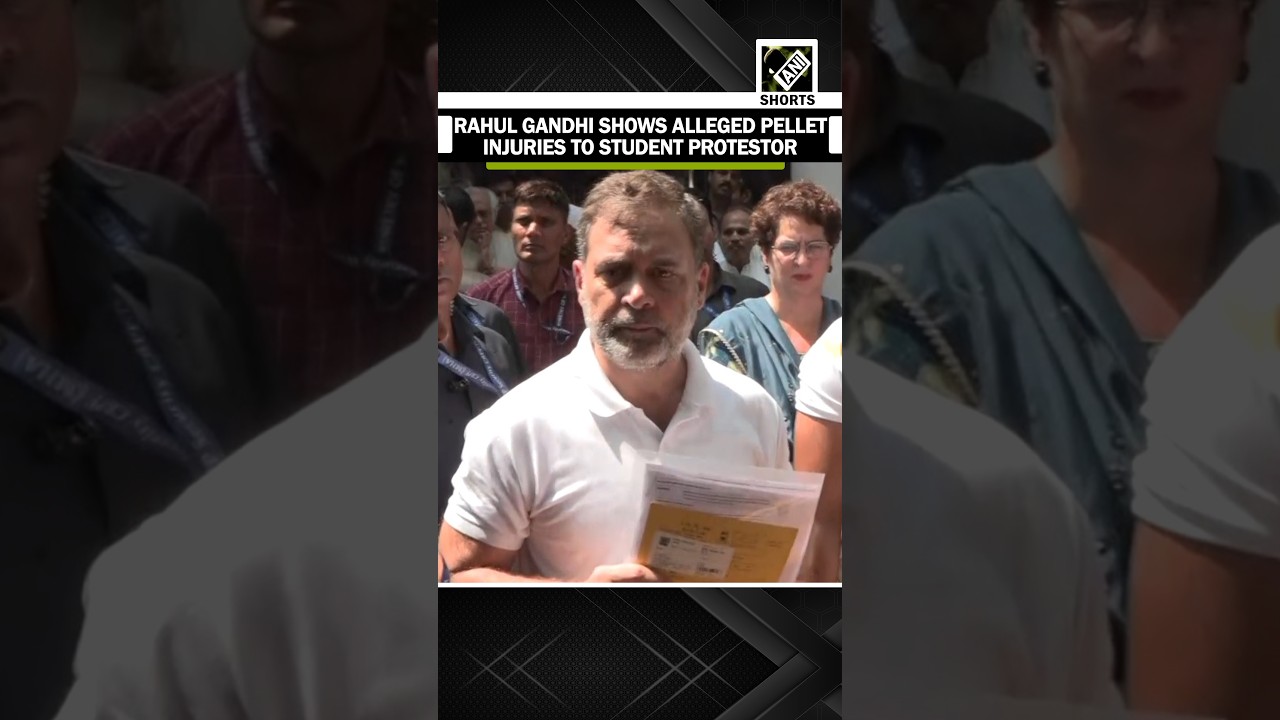 LS LoP Rahul Gandhi shows alleged pellet injuries to student protestor Sahil Lochav