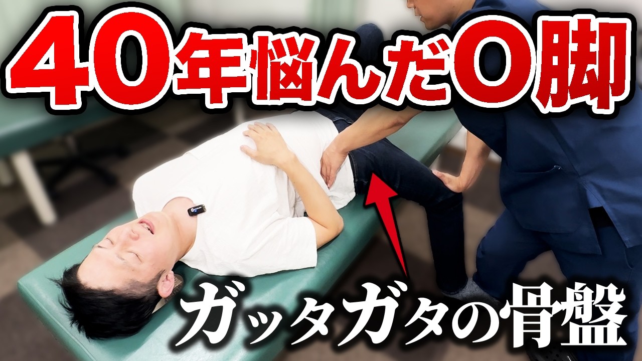 【O脚改善】40年悩んだ最悪の歪みを悶絶整体でバチッと整える！