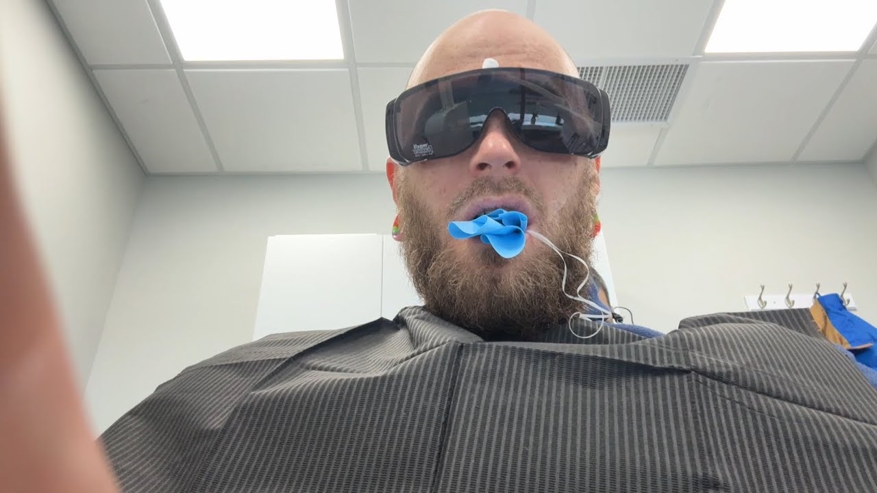 Got A ROOT CANAL