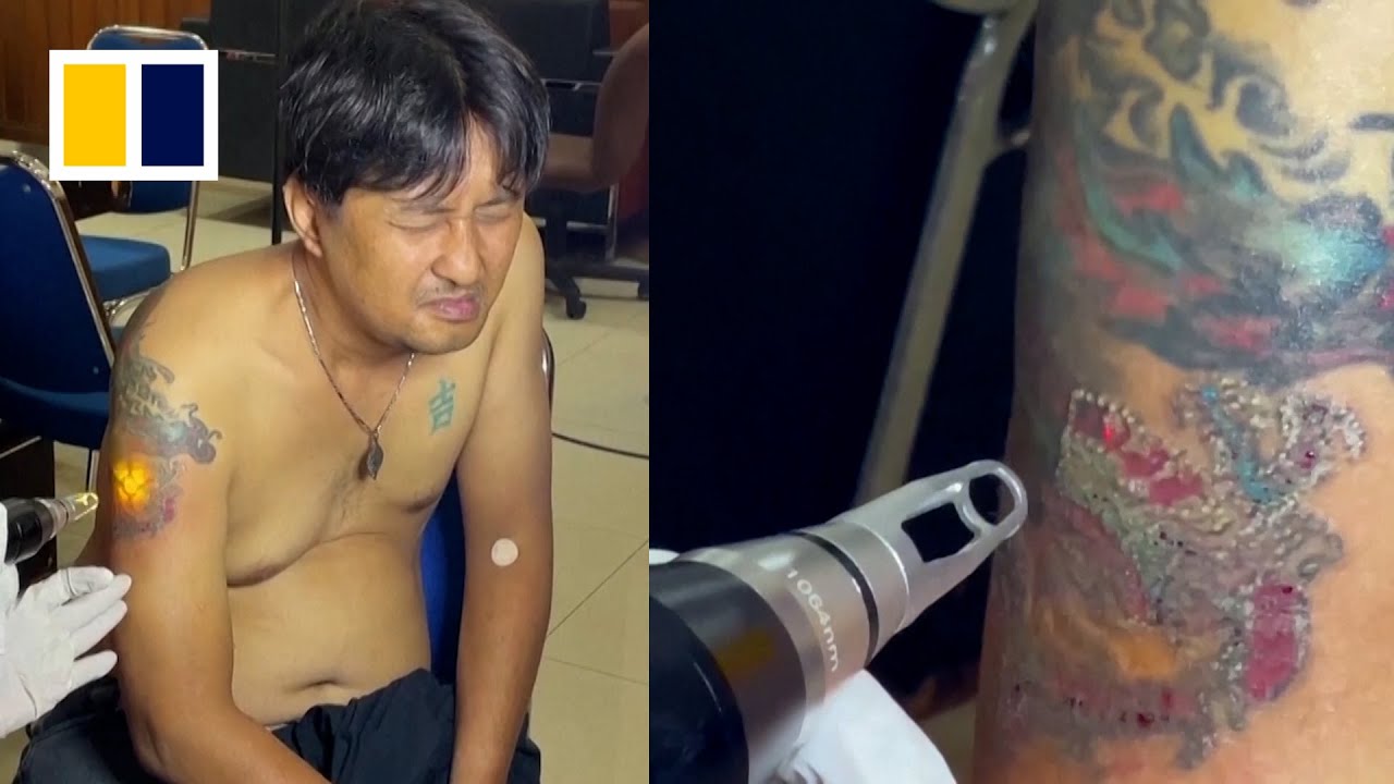&lsquo;To erase tattoos is a form of worship to Allah&rsquo;