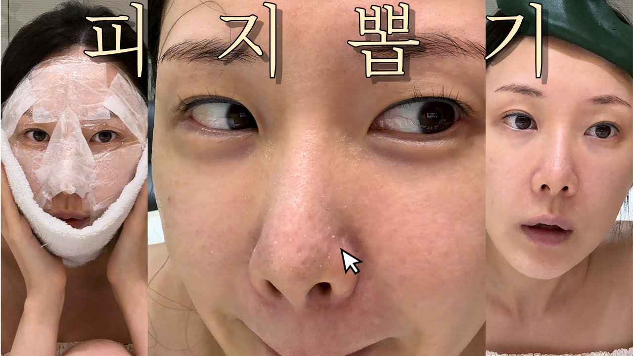 피부과 각질코스 혼자 집에서 하는 법 (feat.10년차 피부과 직원)