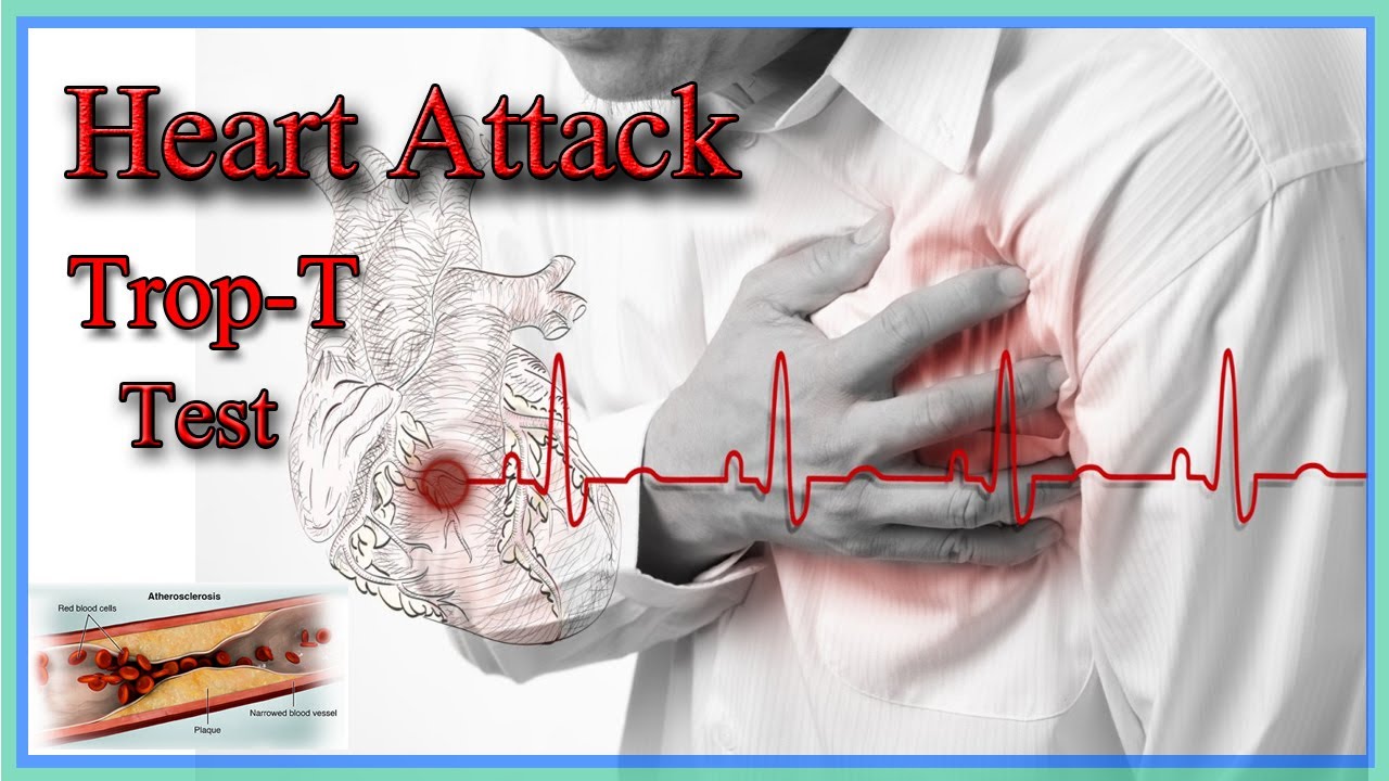 How To Heart Attack Test | Trop-T | By Harib Lab