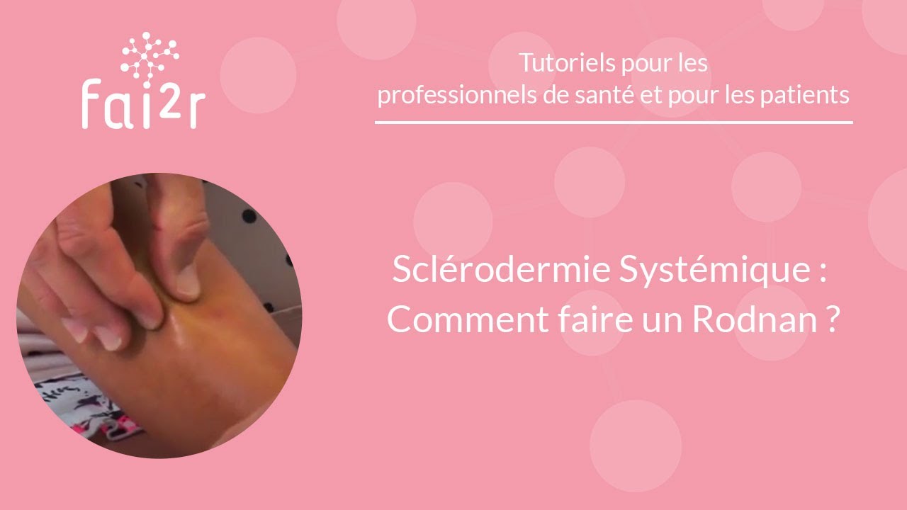 Sclérodermie Systémique : Comment faire un Rodnan ?