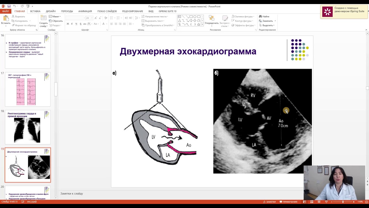 Видеолекция: Пороки аортального клапана  МХ