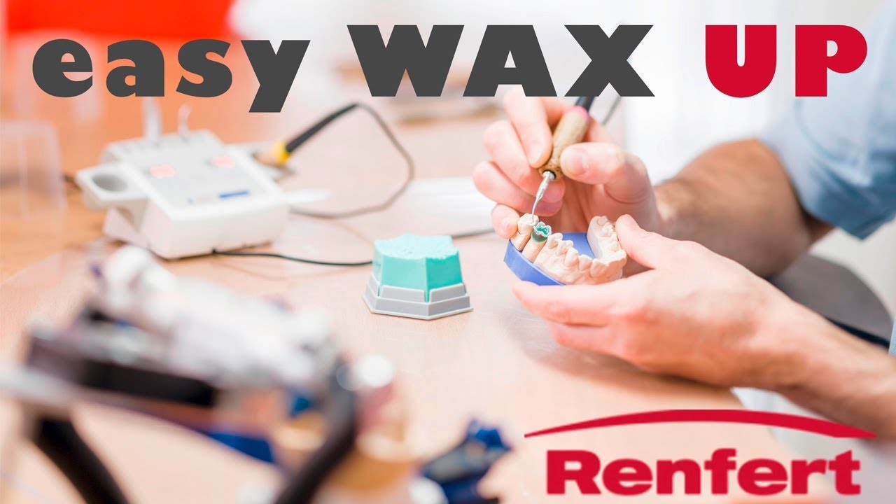 WAX UP, Восковое моделирование восками RENFERT