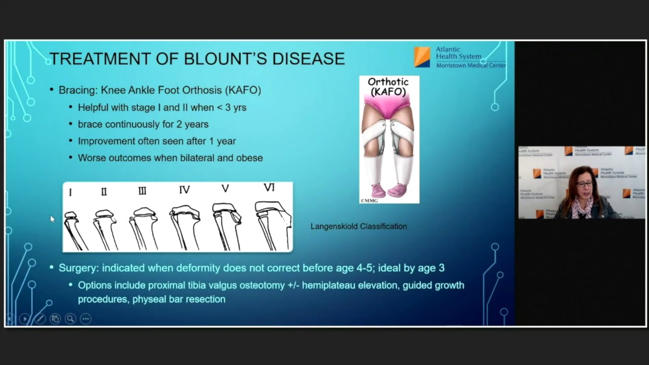 XOXOs of Limb Alignment – Genu Varum & Genu Valgum | Barbara Minkowitz, MD