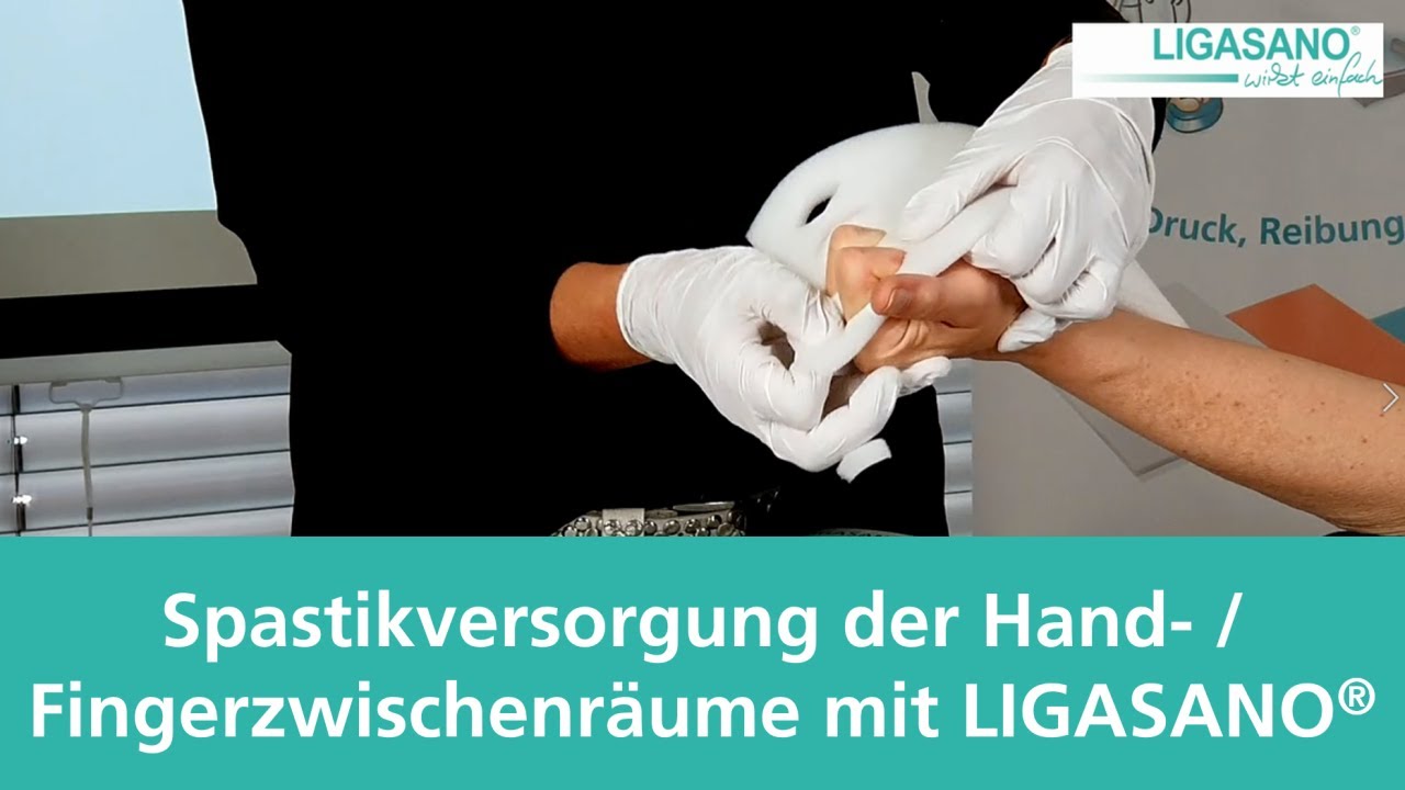 Spastikversorgung der Hand- und Fingerzwischenräume mit LIGASANO®