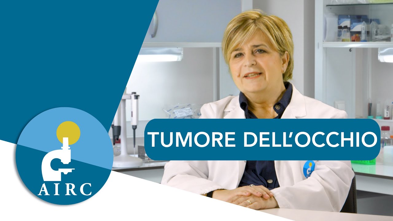 Tumore all'occhio: sintomi, prevenzione, cause, diagnosi