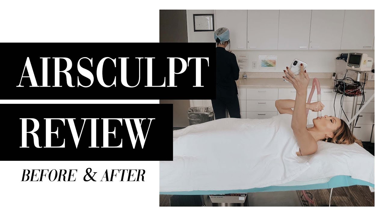 5-Month Airsculpt Review | Before & After