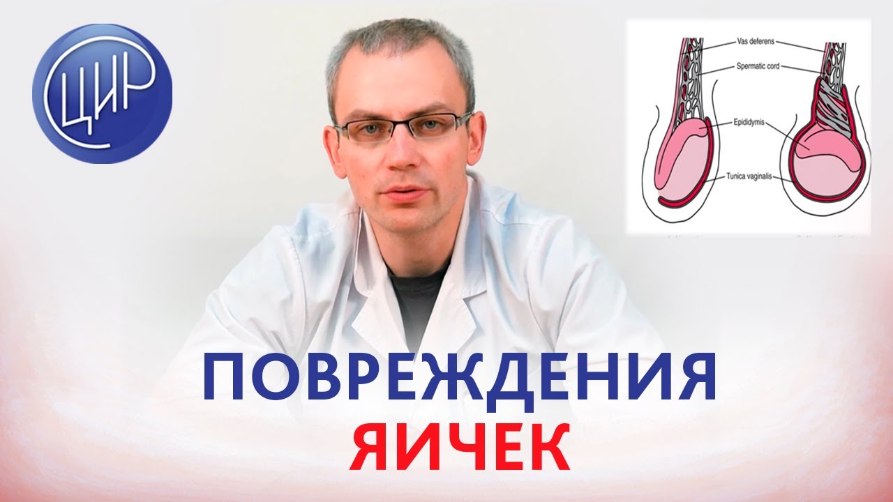 Повреждение яичек, азооспермия и мужское бесплодие. Хирургическое лечение варикоцеле. Живулько А.Р.