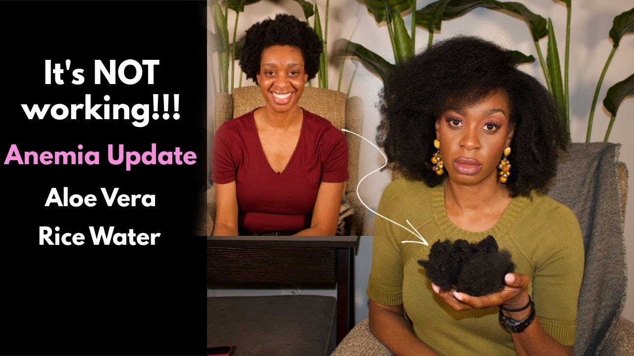 Anemia and hair loss update: Try this before you give up on your 4c hair 2021