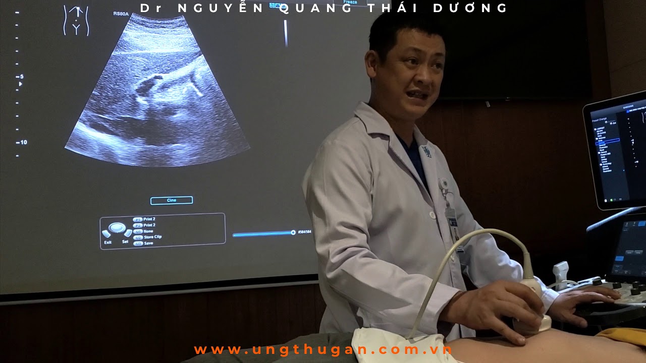 N26 - CÁC MẶT CẮT THỰC HÀNH - PHẦN 5 - ( KHẢO SÁT VÙNG RỐN GAN, ĐƯỜNG MẬT NGOẠI GAN VÀ ĐẦU TỤY)