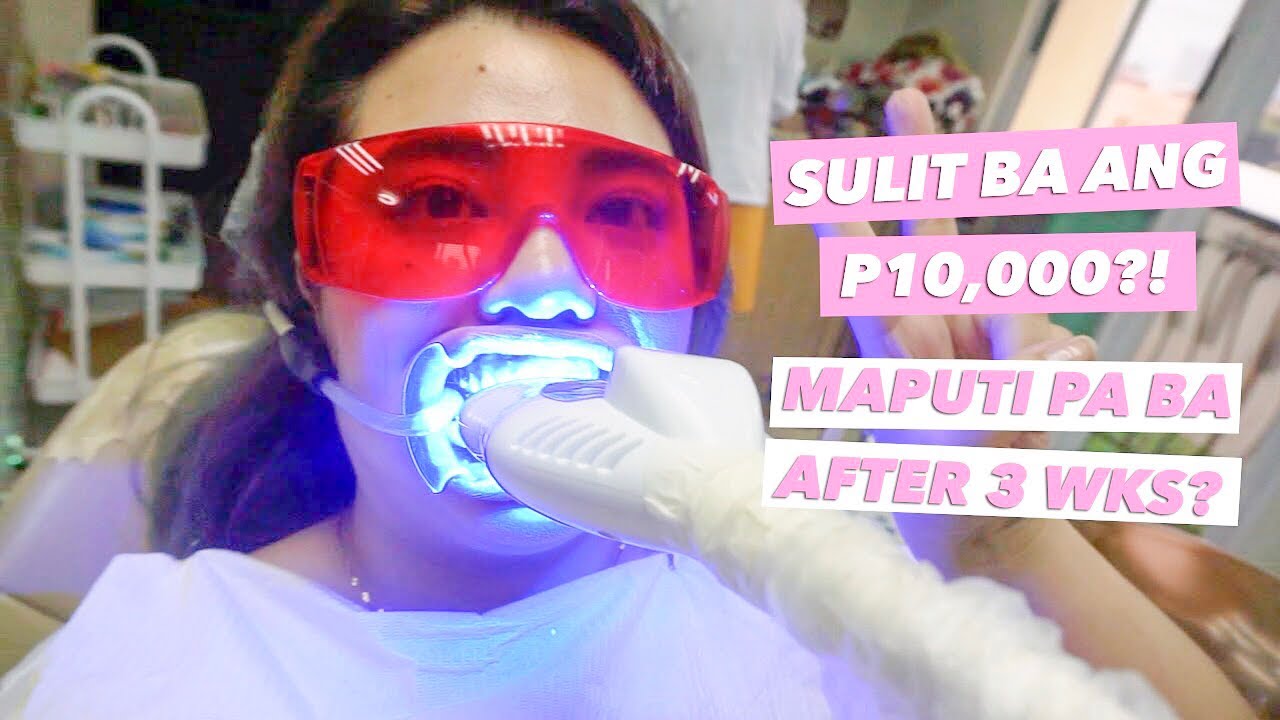 SULIT BA ANG PROFESSIONAL TEETH WHITENING?! with 3 WEEK UPDATE! | HelenOnFleek
