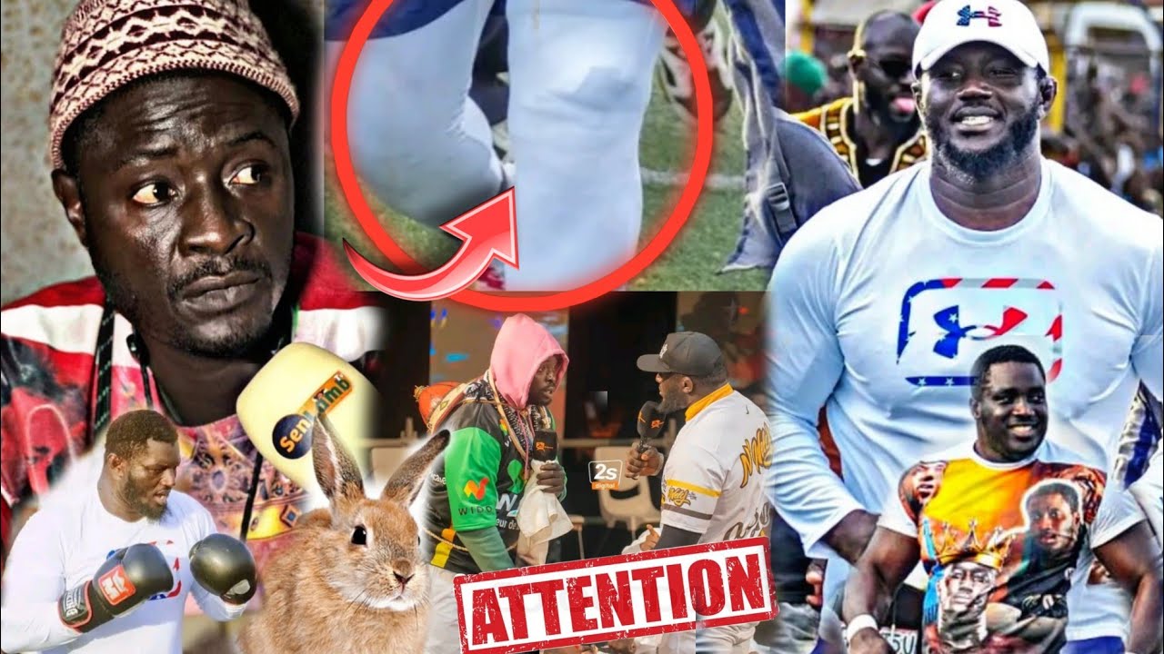 Balla Gaye dafa blessé si Genou..Hey Pimpi Wilipende Ballla..Sougn ko dané bouma wah dafa blessé..