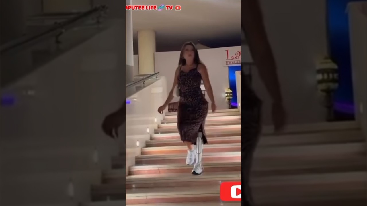 Beautiful amputee lady prosthetic user | mobility 