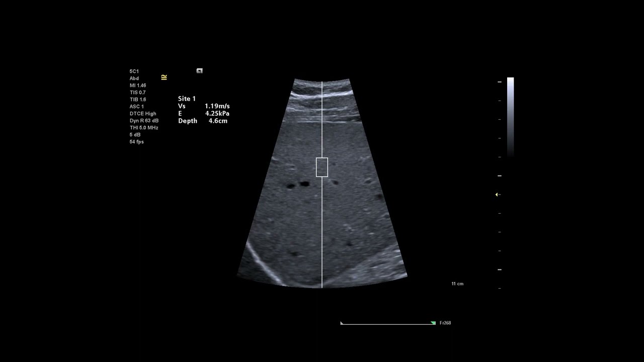Siemens Juniper is the ultrasound cover 19 transducers to expand clinical offerings.
