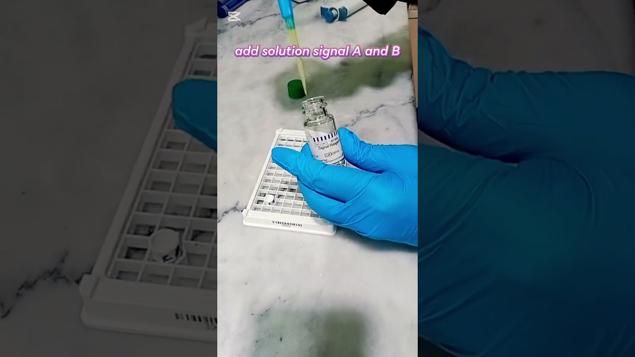 CA-125 test.   Chemiluminescence Immunoassay (Clia) Method step by step