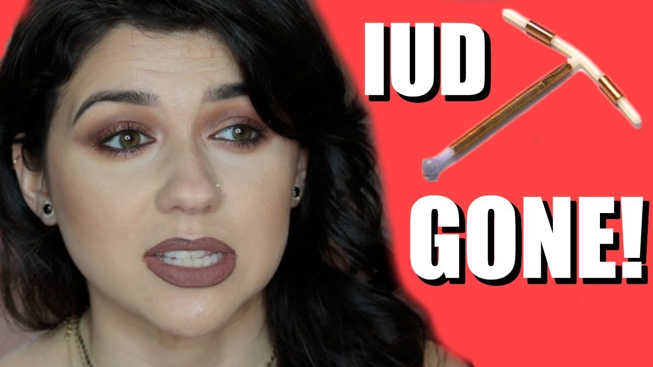 I GOT MY IUD REMOVED - IUD PARAGARD UPDATE