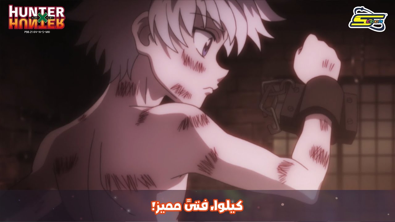 سبيستون | Hunter x Hunter -  كيلوا، فتىً مميز!
