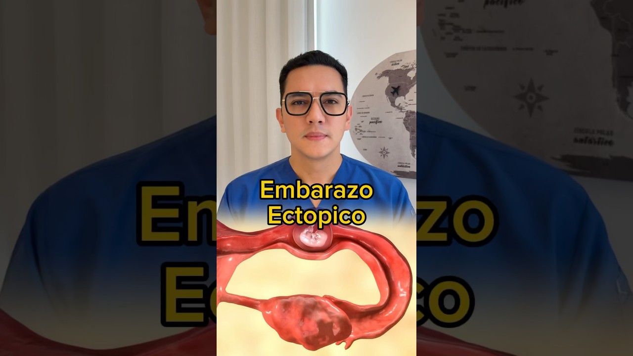 Embarazo ect&oacute;pico: s&iacute;ntomas de alerta que toda mujer debe conocer. #medicina #shorts #ginecologia