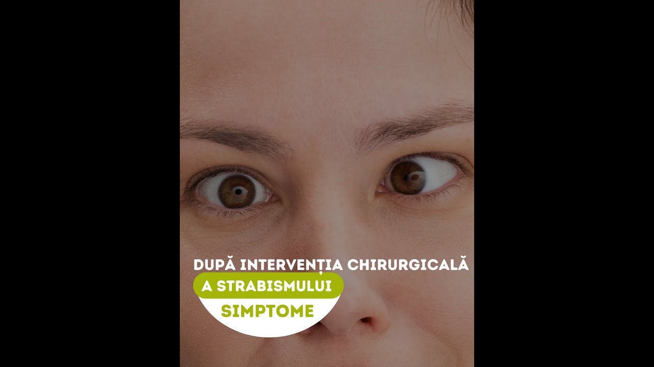 Simptome după intervenția chirurgicală a strabismului | Dr. Servet Yașar