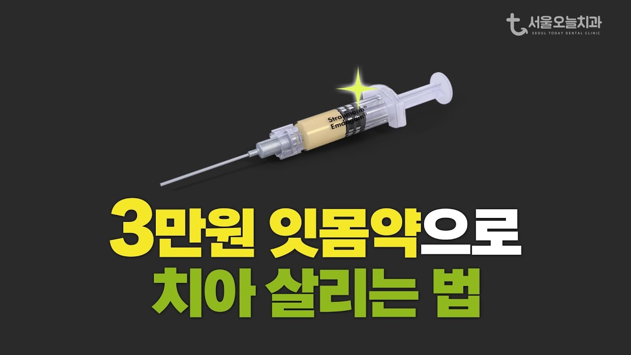 발치 대신 치아 살리는 법? 잇몸뼈 재생 치료 엠도게인 알려드립니다