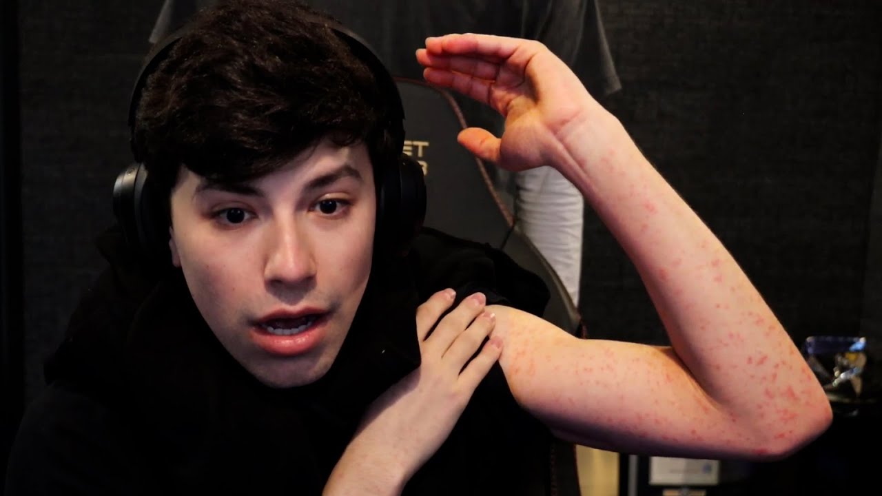 I ALMOST DIED (actually not clickbait)