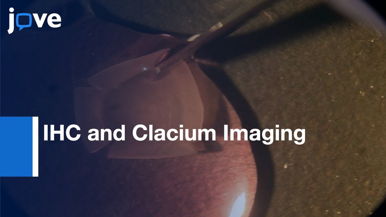 IHC and Clacium Imaging in Wholemount Rat Retina | Protocol Preview