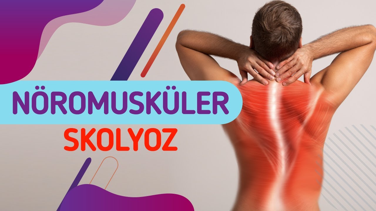 Nöromusküler Skolyoz Nedir? Nöromusküler Skolyoz Neden Olur? Tedavi Seçenekleri ve Ameliyatı