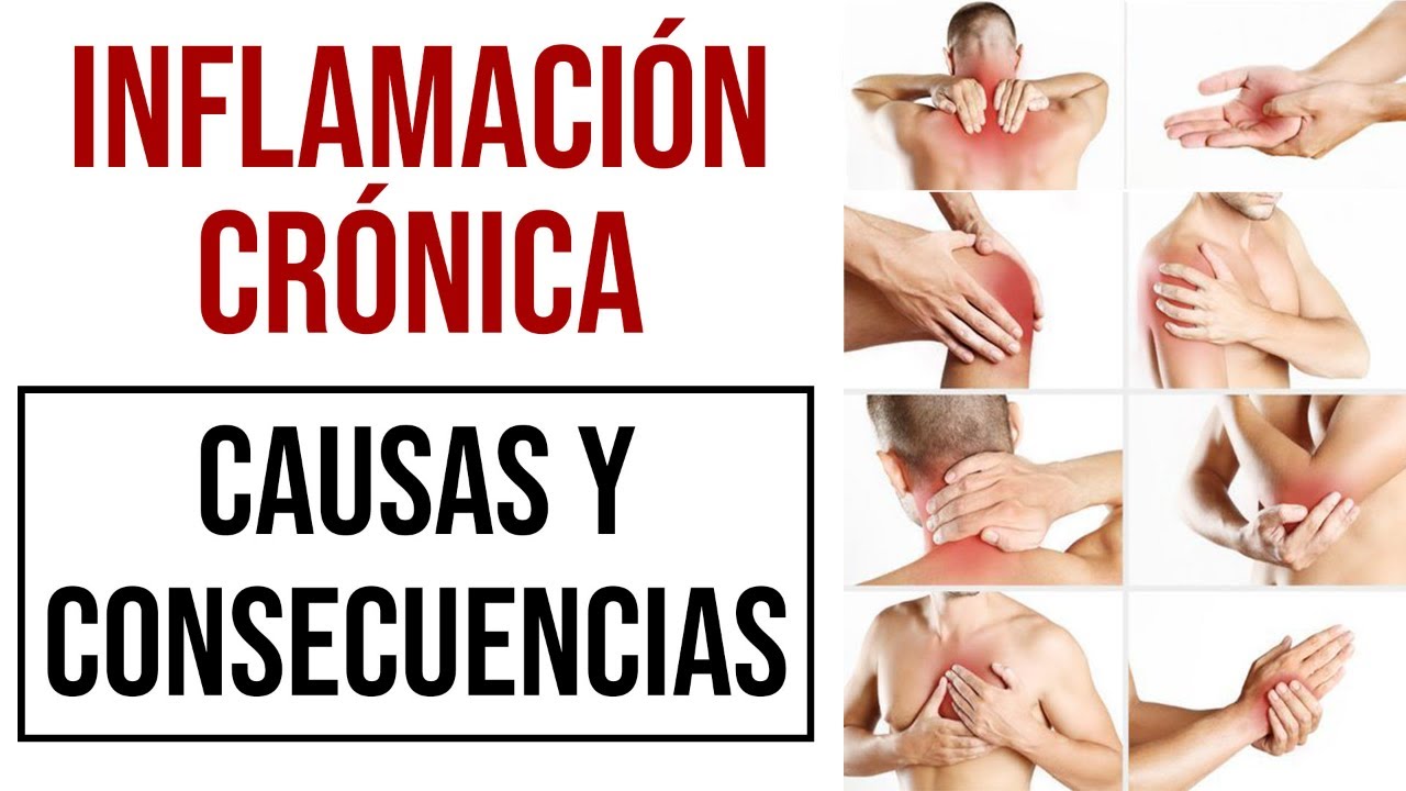 🔥&iquest;Por qu&eacute; tenemos INFLAMACI&Oacute;N CR&Oacute;NICA? 👉🏼 &iexcl;&iexcl;Realiza estos cambios y ev&iacute;tala!! (Marta Marc&egrave;)