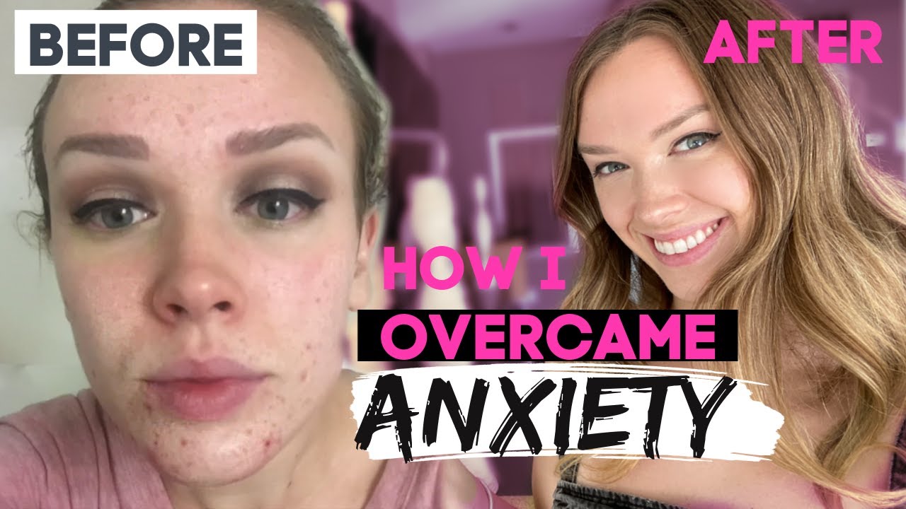 How I Changed My Life and Overcame Anxiety NATURALLY! | These tips changed my life!