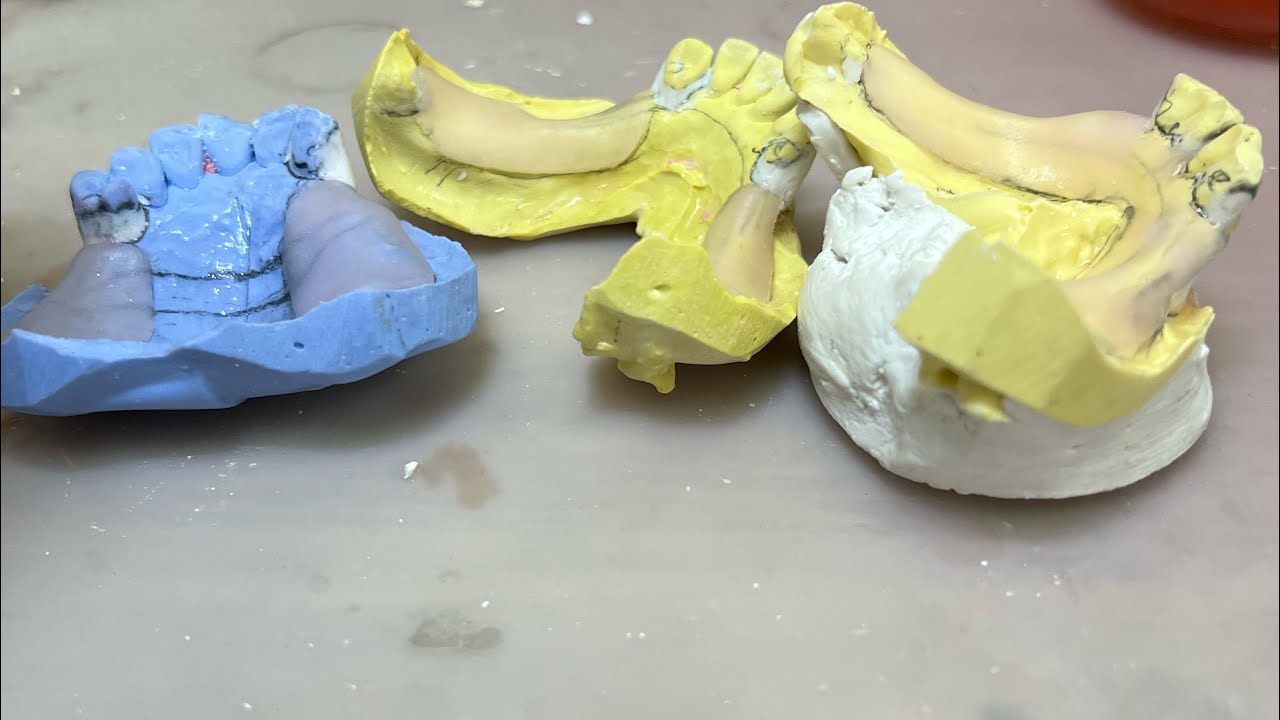 🔰クラスプ付きベースプレートの作り方