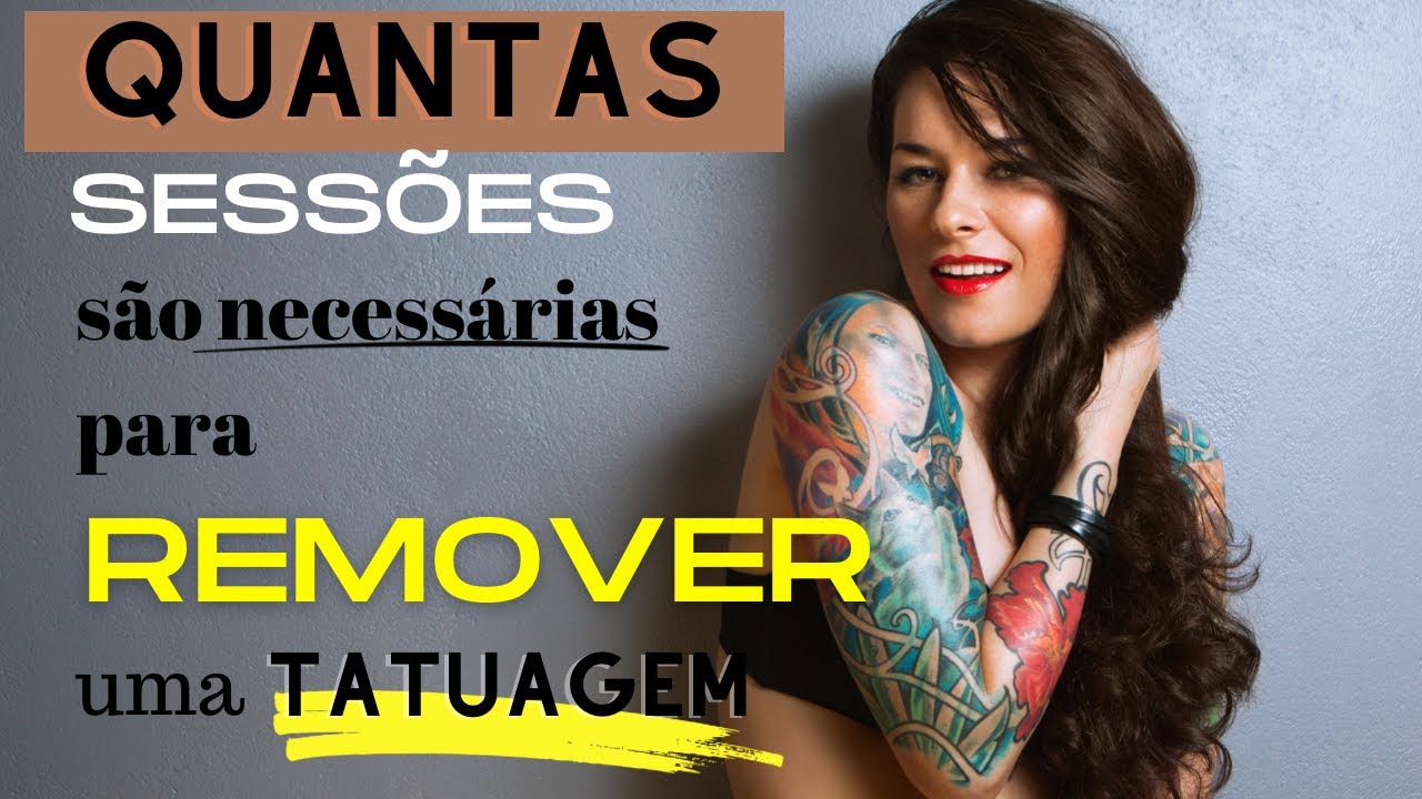 Quantas sessões são necessárias para se remover uma tatuagem?