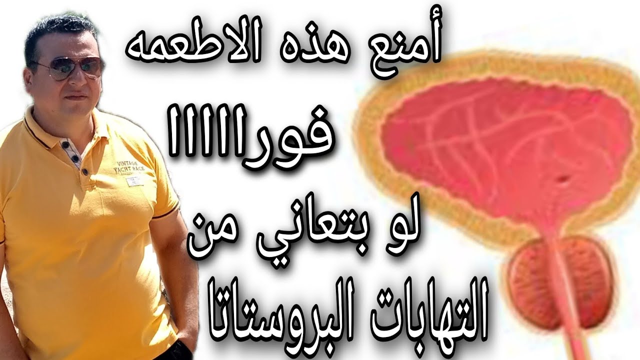 أطعمه ممنوعه لمريض البروستاتا . ترفع الالتهابات وتزيد التضخم وتؤخر الشفاء