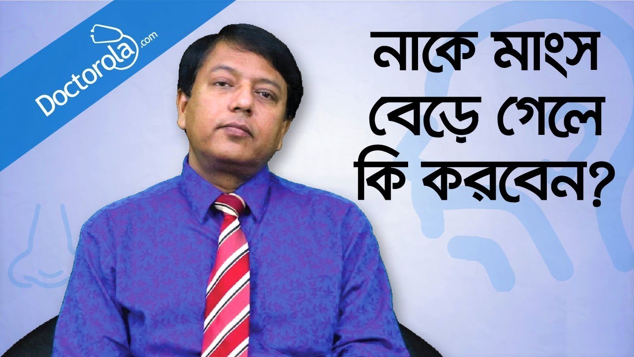 Hypertrophy nasal turbinates - নাকের মাংস বৃদ্ধি - নাকের মাংস বাড়লে করণীয় - Blocked nose relief