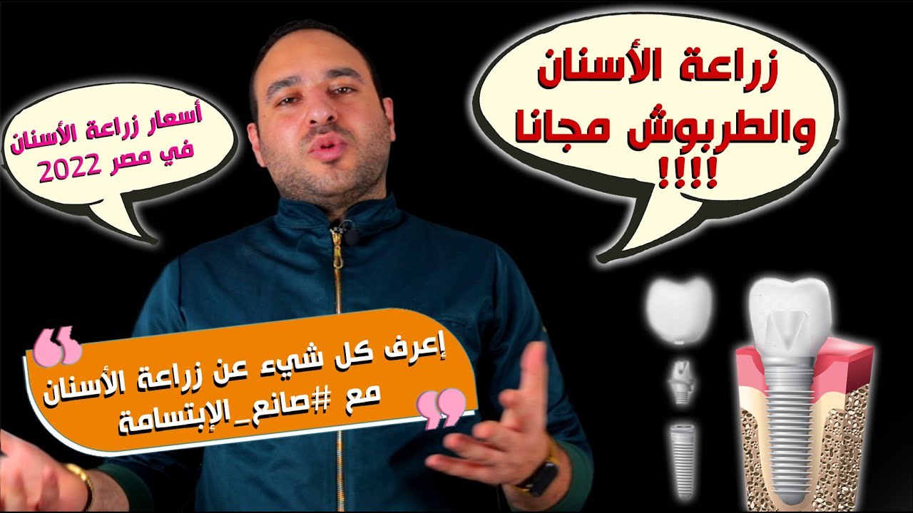 سعر زراعة الأسنان في مصر2022 (الزرعة والطربوش مجانا)