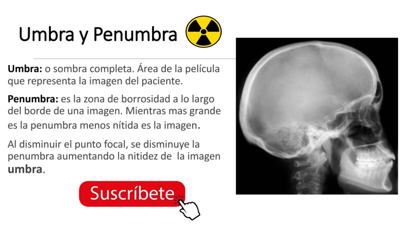 UMBRA Y PENUMBRA EN RX Y El PUNTO FOCAL...