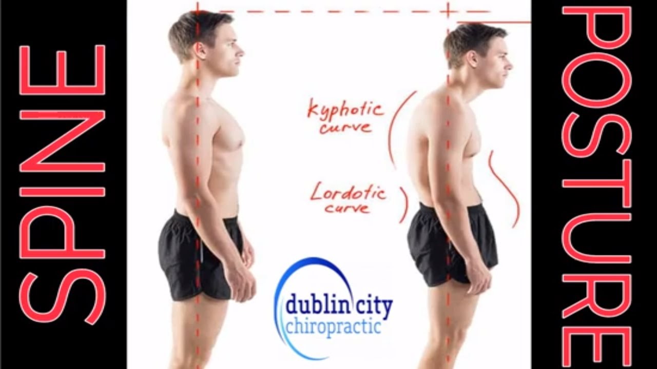 Posture - The Spine - Back Pain | Dublin City Chiropractic