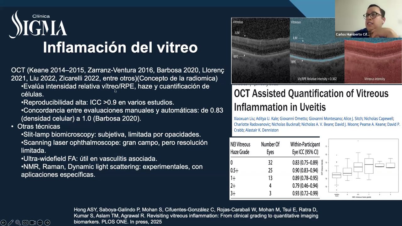 Aplicaciones Actuales y el Potencial de la IA en Diagnóstico, Clasificación y Respuesta en Uveítis