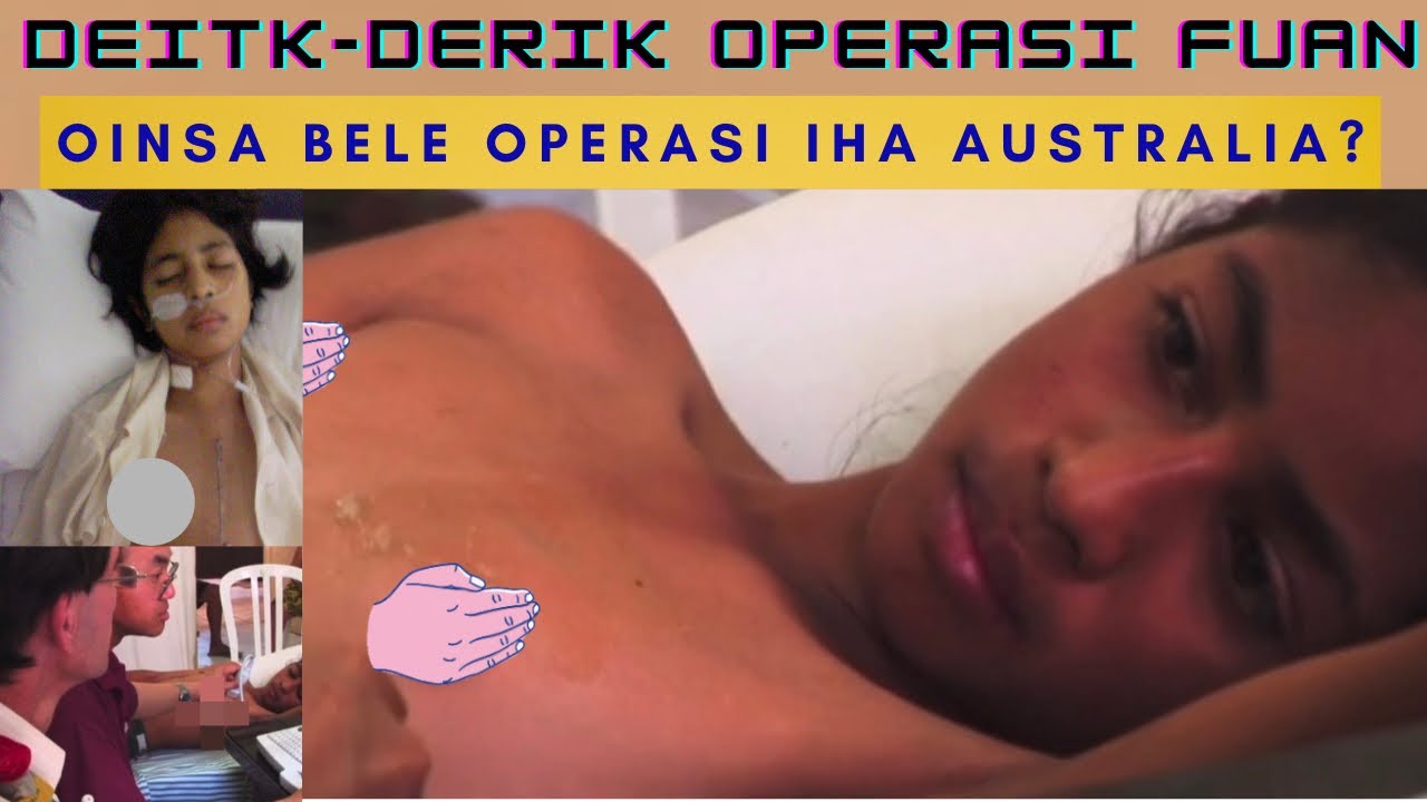 Juliana Fahe Video Privadu kona ba nia operasi fuan iha Australia atu fo korajen ba Pasiente seluk