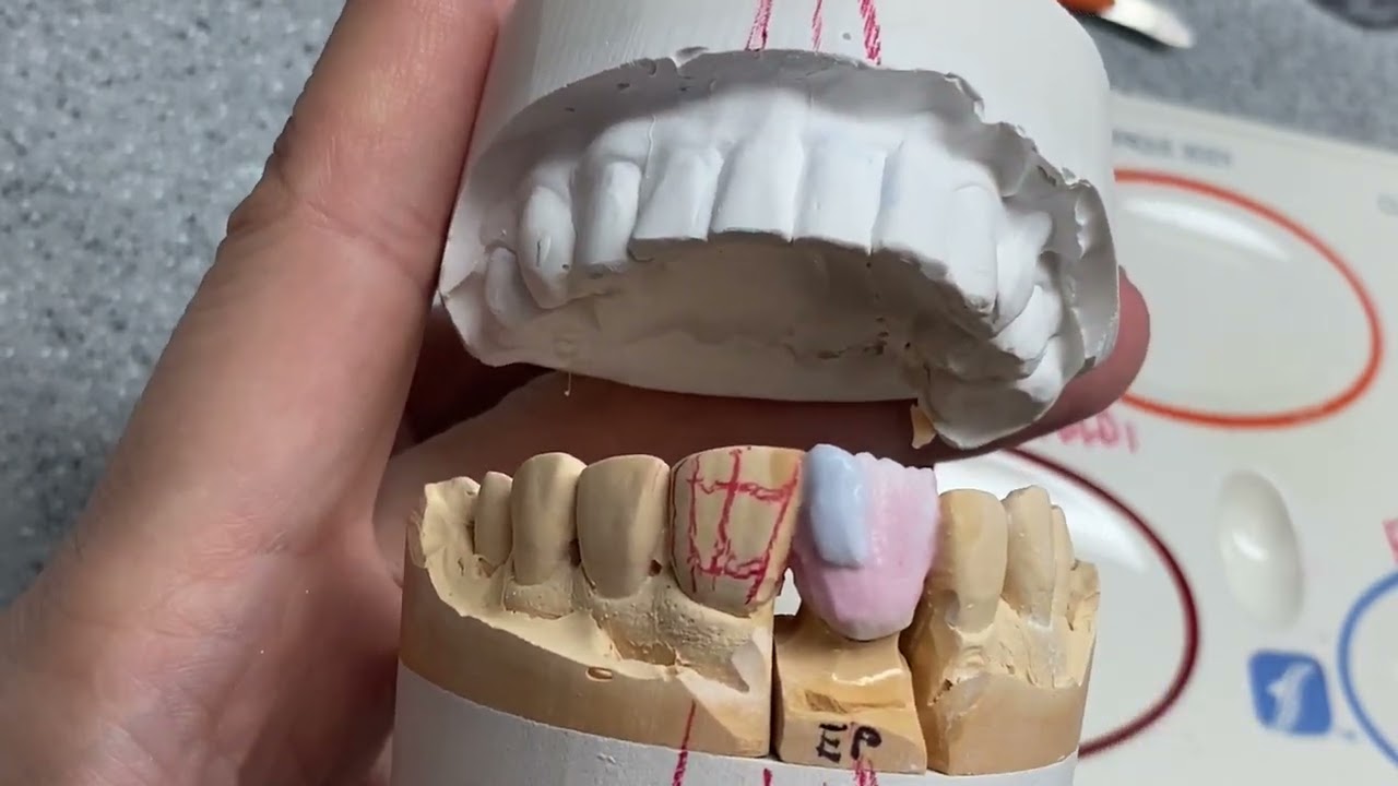 Crown #8 How to Make 2M1 Shade Initial lisi Porcelain
