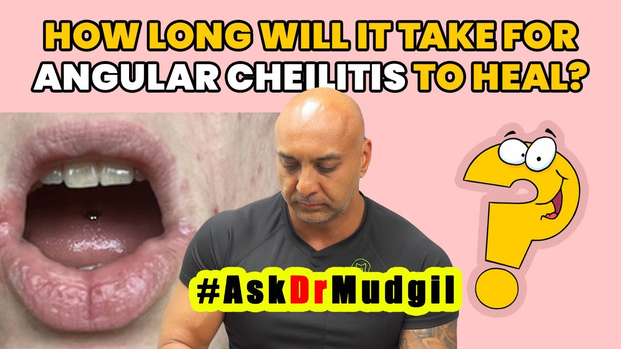 HOW LONG WILL IT TAKE FOR ANGULAR CHEILITIS TO HEAL?