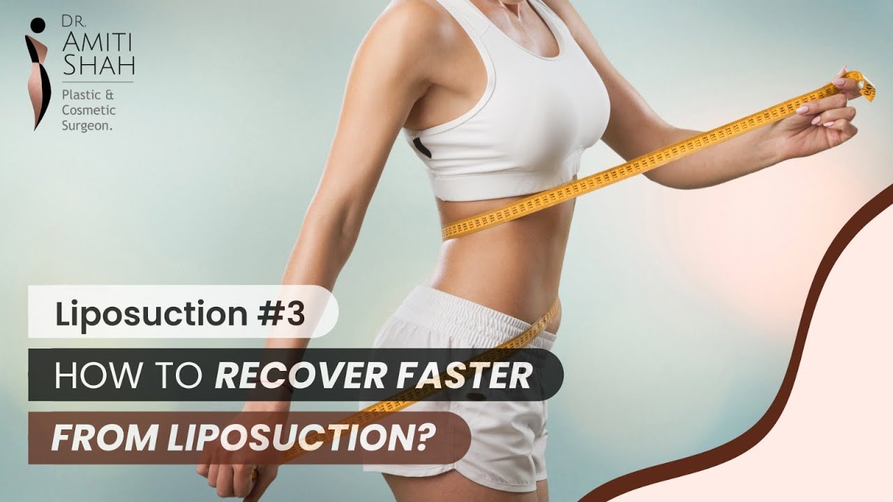 How long does it take to recover after Liposuction? Scarring After Liposuction I Dr. Amiti Shah