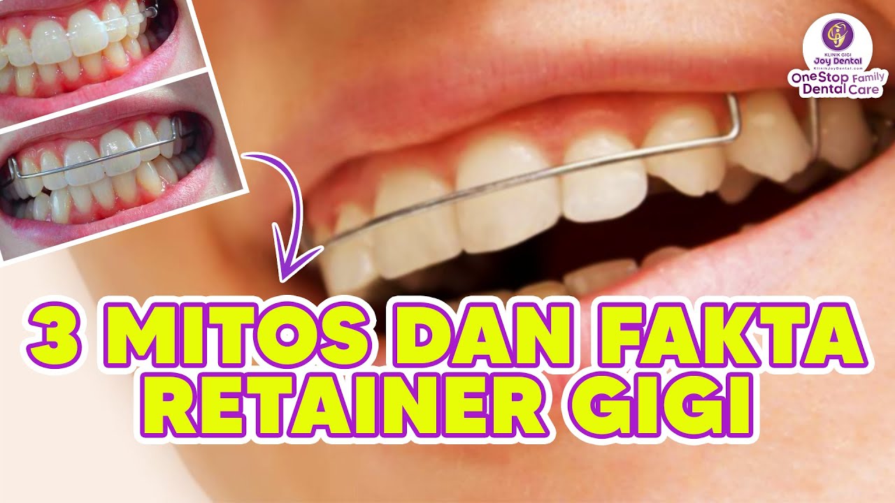 MITOS DAN FAKTA RETAINER GIGI